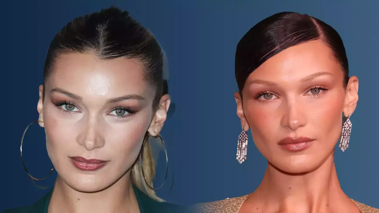 Bella Hadid, Lyme Hastalığı ile İlgili İçten Açıklamalarda Bulundu