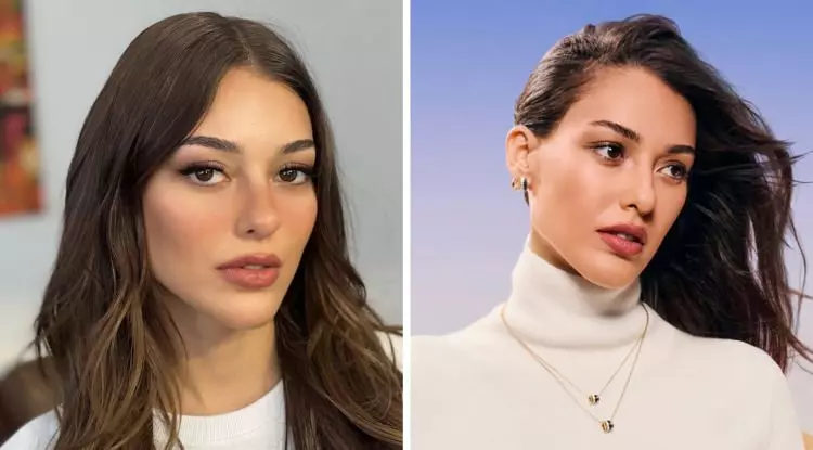 Dilan Çiçek Deniz’in Yüzündeki Değişim Dikkat Çekti