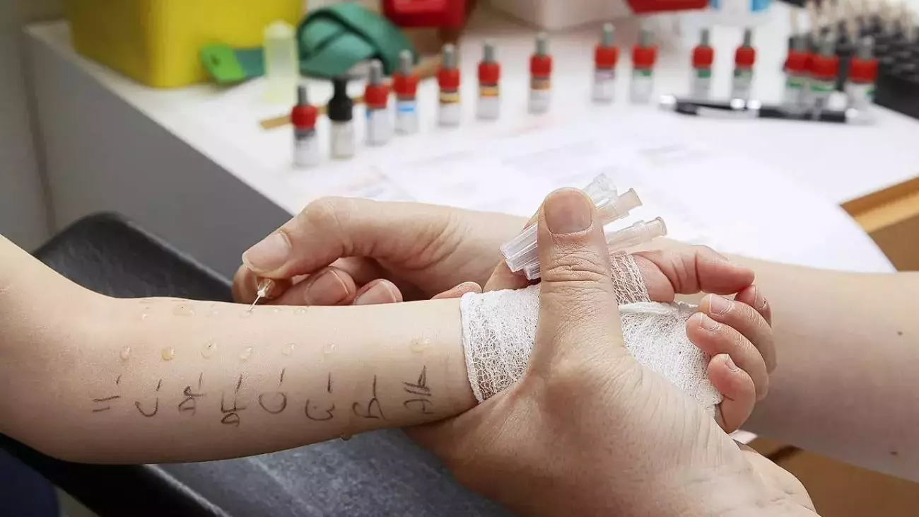 Çocuklarda Alerji Testi: Deri Prick Testi Hakkında Bilmeniz Gerekenler