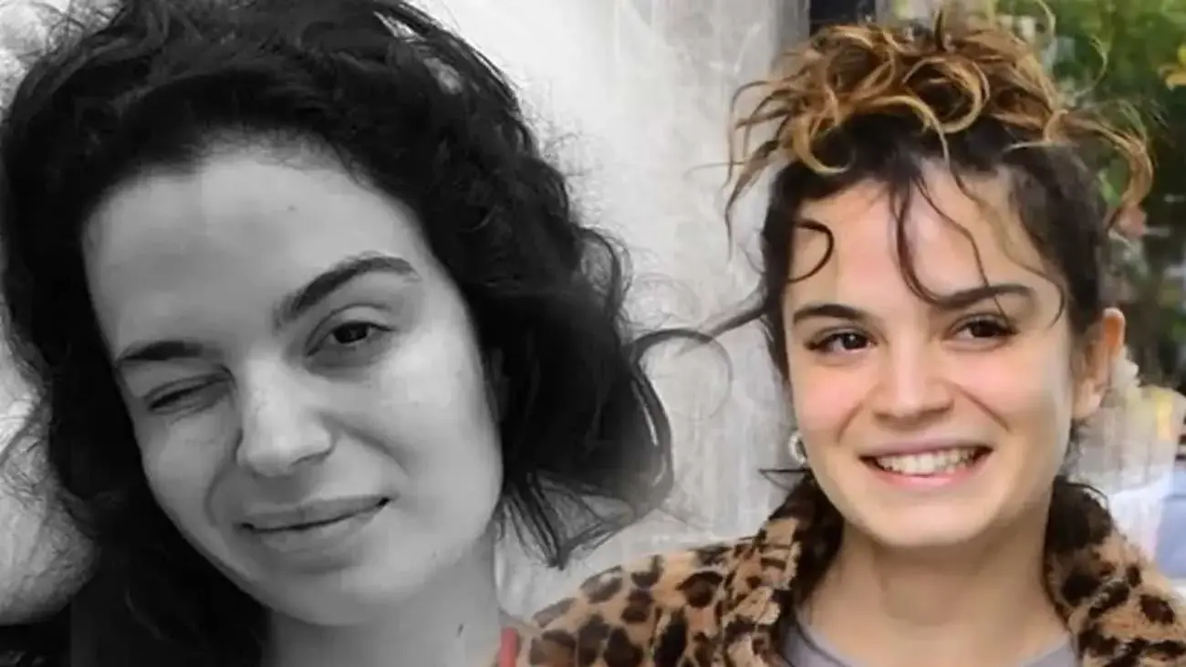 Aslı Bekiroğlu Düz Yolda Düşerek Yaralandı: Nazar İsyanı