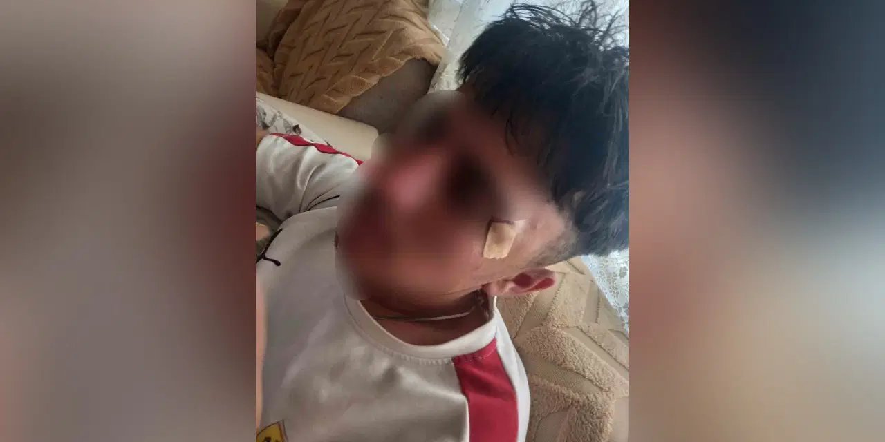 “Öğretmen öğrenciye kafa attı” iddiasına soruşturma