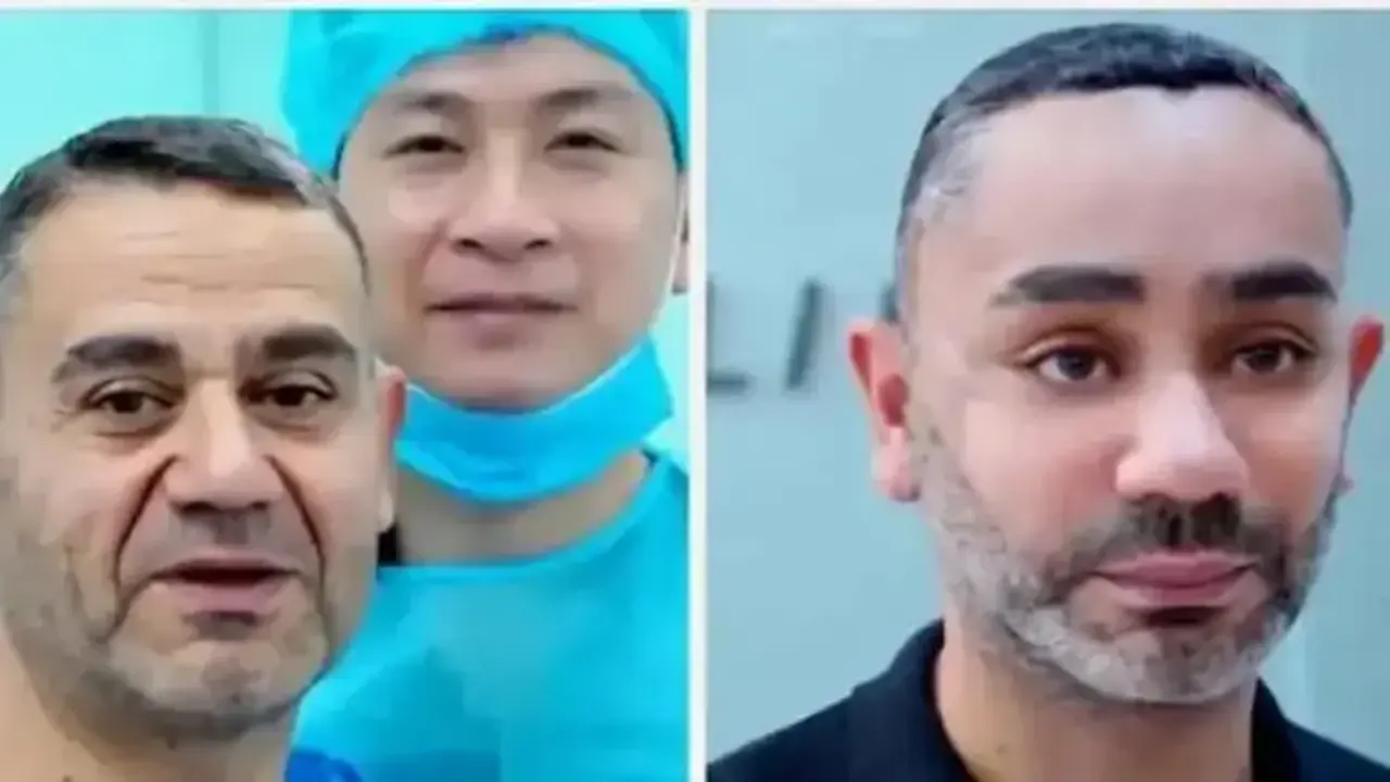 Vietnam estetik operasyonu sonrası yüzündeki değişim